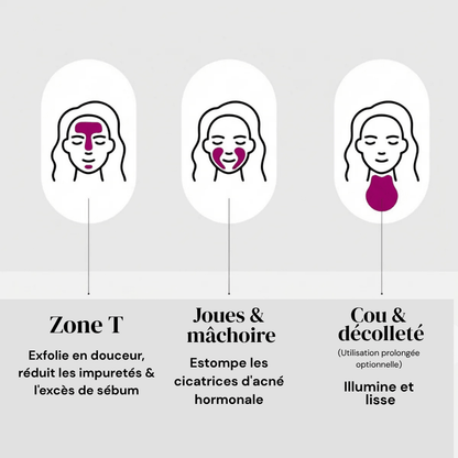 Gloe Arbutine 7% + Acide Tranexamique 4% Crème